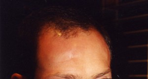 Judge rules against city of Boulder in Seth Brigham restraining order case