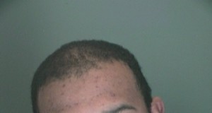 More accounts of inmate abuse surface at jail