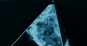 New study finds increase in birth defects near fracking sites