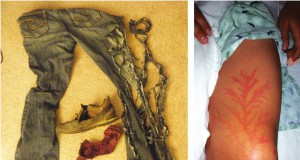 A bolt out of the blue