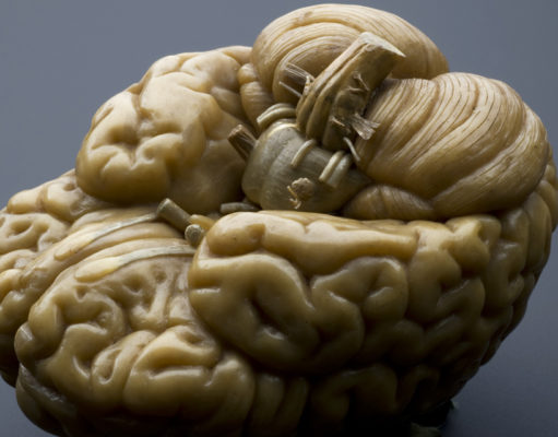 Taking a tolerance break