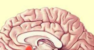 This is your brain on drugs