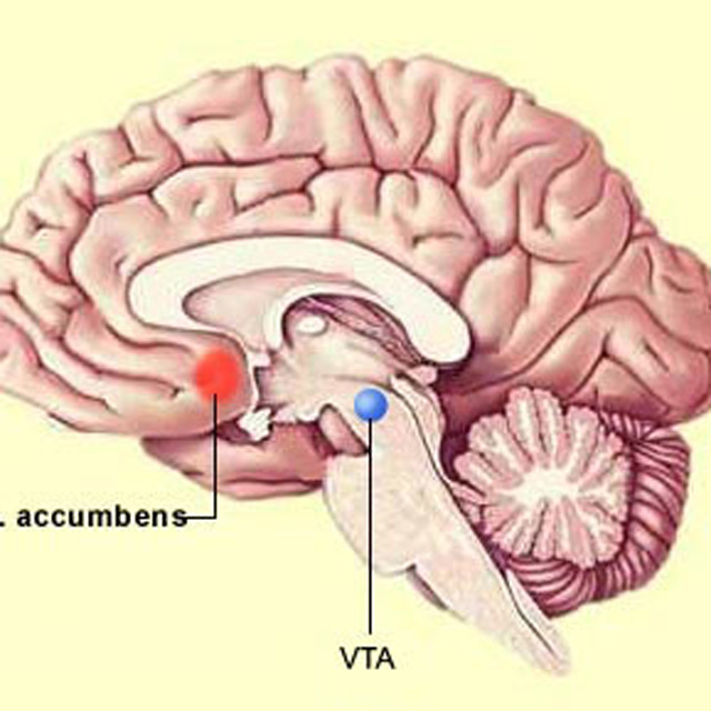This is your brain on drugs